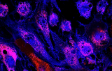 RET probe for FISH CE/IVD - Pulmonary pathology