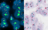 In situ Hybridization