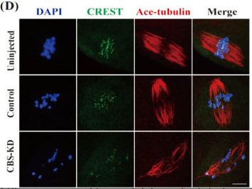 Frontiers  SUMO control of centromere homeostasis