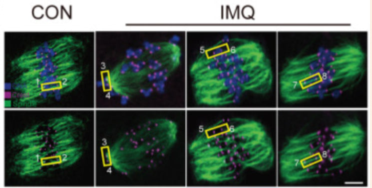 Frontiers  SUMO control of centromere homeostasis