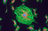 FUS probe for ISH CE/IVD - Sarcomas