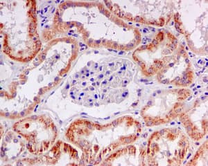 Anticuerpos para patología