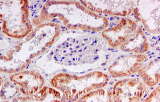 Inmunohistoquímica (IHC)